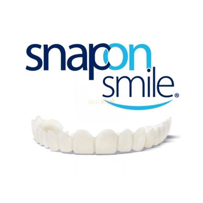 Snap-On Smile - dýhy v Liberci